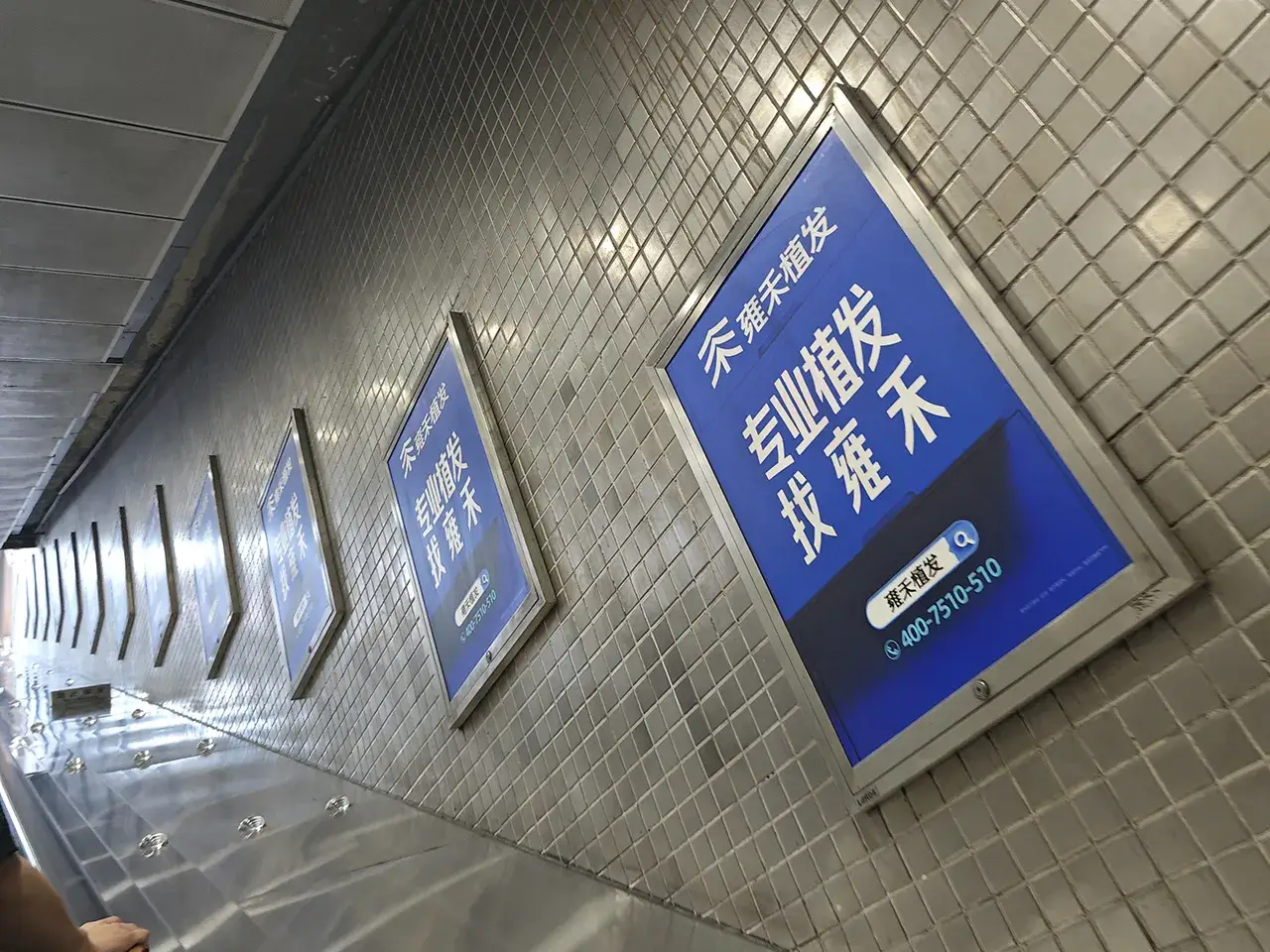 牛马该植发了！